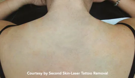 q plus tattoo post1 - לי דניאלס