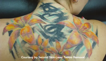 q-plus-tattoo-pre1-450×262 q plus tattoo pre1 - לי דניאלס