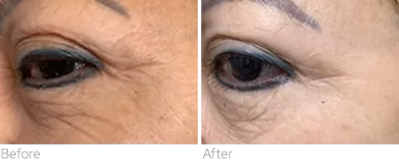 imageye___-_60eb10_f34fbf56cb4542af8477d71516e9615f~mv2